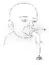Fig. 01 - Nebulizer having replaceable nozzle assembly and suction line