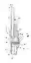Fig. 02 - Nebulizer having replaceable nozzle assembly and suction line