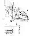 Fig. 04 - Nebulizer having replaceable nozzle assembly and suction line