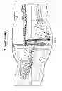 Fig. 06 - Nebulizer having replaceable nozzle assembly and suction line
