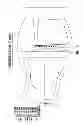 Fig. 16 - Nebulizer having replaceable nozzle assembly and suction line