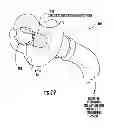 Fig. 20 - Nebulizer having replaceable nozzle assembly and suction line
