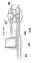 Fig. 22 - Nebulizer having replaceable nozzle assembly and suction line