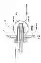 Fig. 23 - Nebulizer having replaceable nozzle assembly and suction line