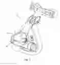 Fig. 03 - Vent system for CPAP patient interface used in treatment of sleep disordered breathing