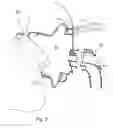 Fig. 04 - Vent system for CPAP patient interface used in treatment of sleep disordered breathing