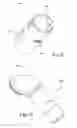 Fig. 09 - Vent system for CPAP patient interface used in treatment of sleep disordered breathing