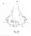 Fig. 23 - Vent system for CPAP patient interface used in treatment of sleep disordered breathing