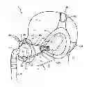 Fig. 01 - Patient interface assembly with self-adjusting anchor points