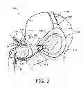 Fig. 03 - Patient interface assembly with self-adjusting anchor points