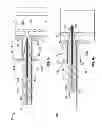 Fig. 02 - Everting device and method for tracheostomy