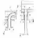 Fig. 04 - Everting device and method for tracheostomy