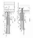 Fig. 05 - Everting device and method for tracheostomy