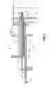 Fig. 08 - Everting device and method for tracheostomy