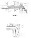 Fig. 09 - Everting device and method for tracheostomy