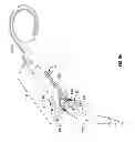 Fig. 14 - Everting device and method for tracheostomy