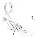 Fig. 15 - Everting device and method for tracheostomy