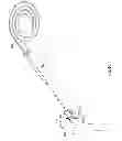 Fig. 16 - Everting device and method for tracheostomy