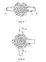 Fig. 17 - Everting device and method for tracheostomy