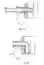 Fig. 20 - Everting device and method for tracheostomy