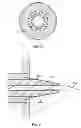 Fig. 22 - Everting device and method for tracheostomy