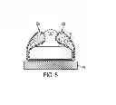 Fig. 06 - SURGICAL POSITIONING SYSTEM