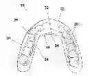 Fig. 01 - DENTAL APPLIANCE