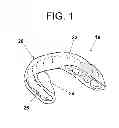 Fig. 02 - DENTAL APPLIANCE