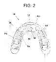 Fig. 03 - DENTAL APPLIANCE
