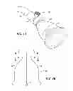 Fig. 05 - SHOWERHEAD CLEANING AND DISINFECTING SYSTEM AND METHOD