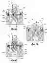 Fig. 05 - Shut-off trim including spring loaded check valve