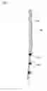 Fig. 05 - Fabric strap with soft side edges