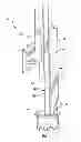 Fig. 02 - Tree removal device and method