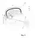 Fig. 04 - THREAD DISPLACEMENT DEVICE