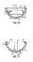 Fig. 07 - Method and apparatus for a well employing the use of an activation ball
