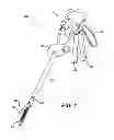Fig. 02 - Providing Near Real Time Feedback To A User of A Surgical Instrument