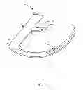 Fig. 02 - Barbed surgical staple