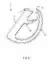 Fig. 03 - Barbed surgical staple