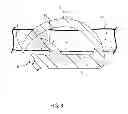 Fig. 04 - Barbed surgical staple
