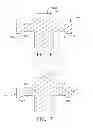 Fig. 05 - Surgical instrument comprising an adjustable system configured to accommodate different jaw heights