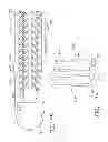 Fig. 115 - Surgical instrument comprising an adjustable system configured to accommodate different jaw heights
