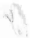 Fig. 14 - Surgical instrument comprising an adjustable system configured to accommodate different jaw heights