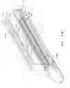 Fig. 85 - Surgical instrument comprising a firing system including a compliant portion