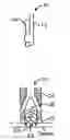 Fig. 01 - Fasteners, deployment systems, and methods for ophthalmic tissue closure and fixation of ophthalmic prostheses and other uses