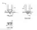 Fig. 07 - Fasteners, deployment systems, and methods for ophthalmic tissue closure and fixation of ophthalmic prostheses and other uses