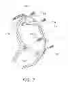 Fig. 07 - Spinning reel