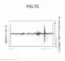 Fig. 43 - Fluid-filled vibration damping device