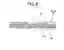 Fig. 07 - PERMANENT MAGNET EMBEDDED TYPE ROTATING ELECTRICAL MACHINE