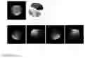 Fig. 04 - Automatic three-dimensional approach method for RF coil assessment in clinical MRI
