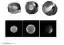 Fig. 05 - Automatic three-dimensional approach method for RF coil assessment in clinical MRI